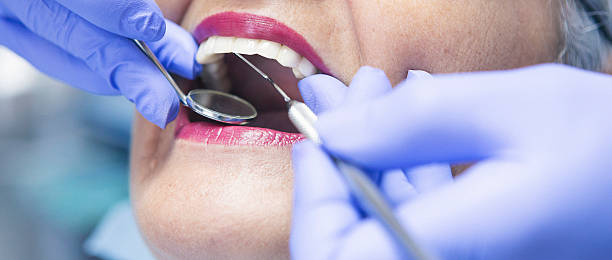 Best Emergency Broken Tooth Repair in Birch Bay, WA